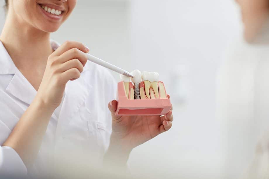 Does the Dental Implant Brand Make a Difference?