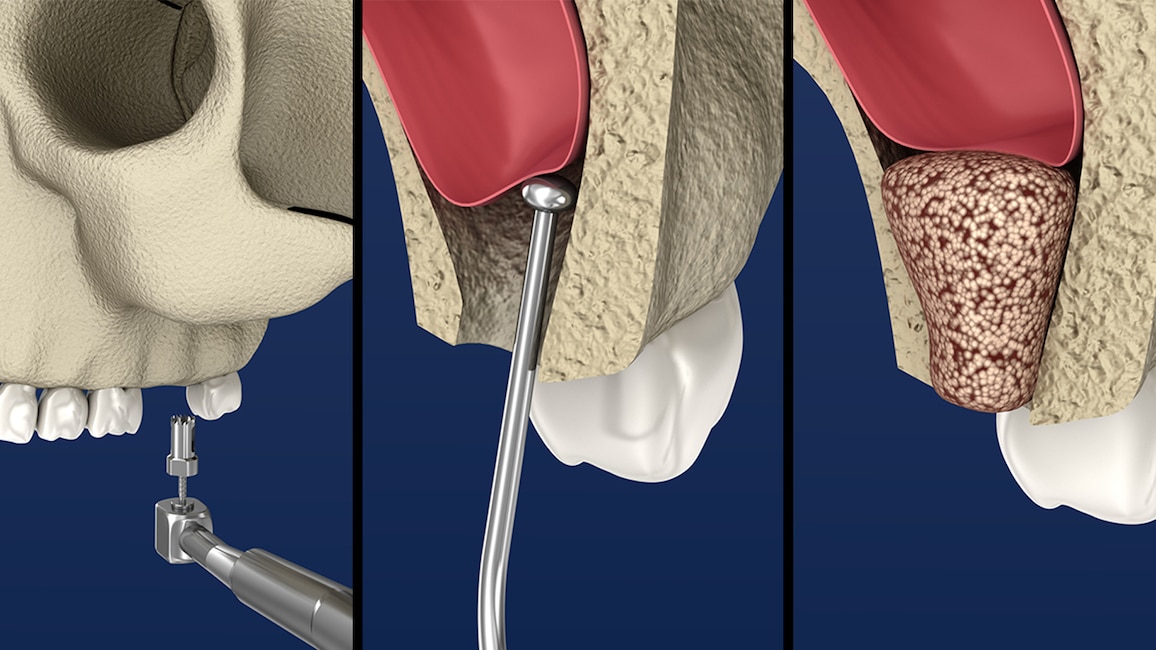 Dental x-rays